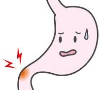 Understanding Duodenal Ulcers: Causes, Symptoms, and Solutions Understanding Duodenal Ulcers: Causes, Symptoms, and Solutions